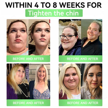 🔥Official Store| 🧑‍⚕️Alcuras™ Moringa × Berberine × AMPK 8-Benefit Slimming & Metabolic Nano Microneedle Patch 🇺🇸  Just once a day · Visible changes in 7 days  ✅ For obesity, loose skin, diabetes, sleep apnea, joint issues, and more