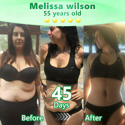 🔥Alcuras™ Moringa × Berberine × AMPK 8-Benefit Slimming & Metabolic Nano Microneedle Patch 🇺🇸 Just once a day · Visible changes in 7 days ✅ For obesity, loose skin, diabetes, sleep apnea, joint issues, and more