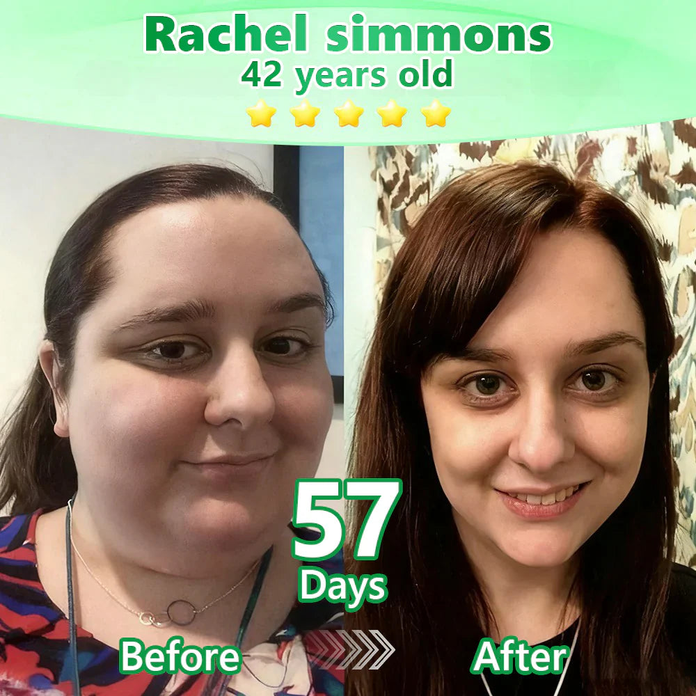 🔥Alcuras™ Moringa × Berberine × AMPK 8-Benefit Slimming & Metabolic Nano Microneedle Patch 🇺🇸 Just once a day · Visible changes in 7 days ✅ For obesity, loose skin, diabetes, sleep apnea, joint issues, and more