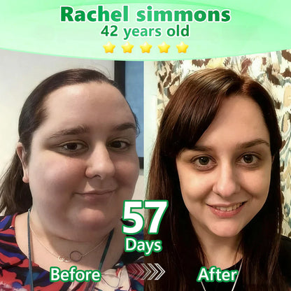 🔥Alcuras™ Moringa × Berberine × AMPK 8-Benefit Slimming & Metabolic Nano Microneedle Patch 🇺🇸 Just once a day · Visible changes in 7 days ✅ For obesity, loose skin, diabetes, sleep apnea, joint issues, and more